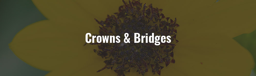 Crowns & bridges