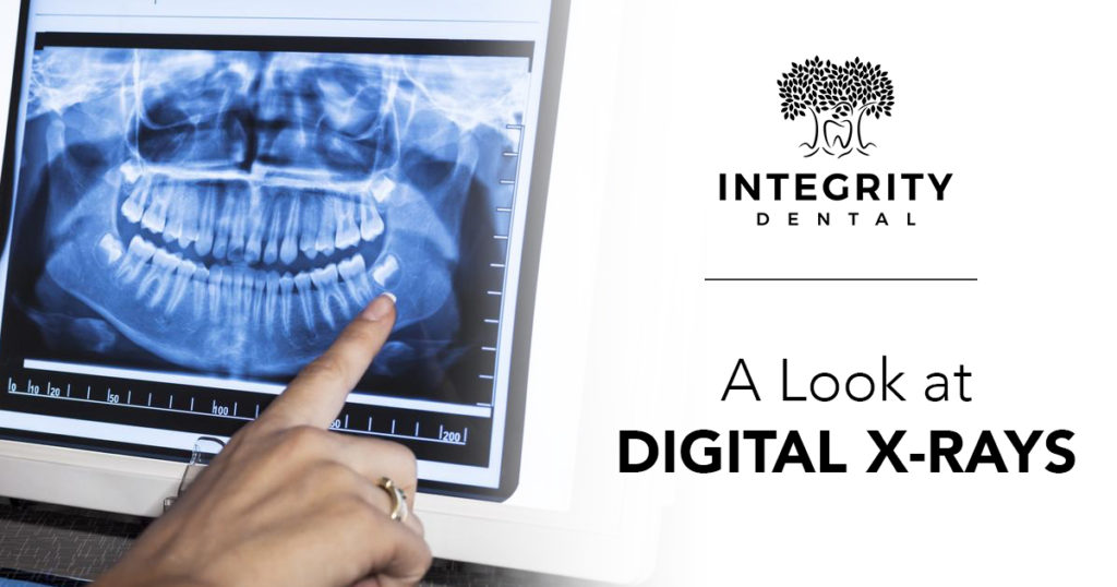 A Look At Digital XRays Integrity Dental