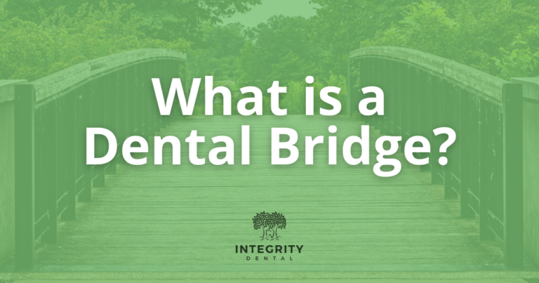 What is a dental bridge?