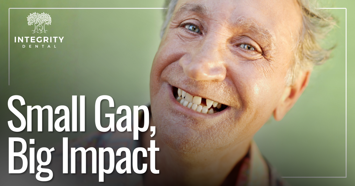 Man smiling with missing teeth