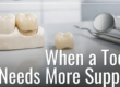 dental crowns