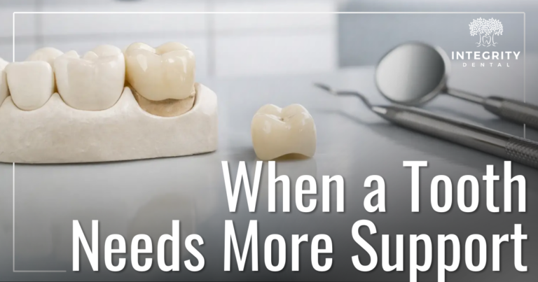 dental crowns