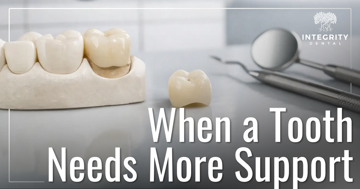 When a Tooth Needs More Support dental crowns
